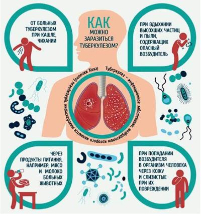 Что такое туберкулез, и каковы источники инфекции?
